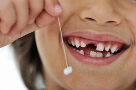 Có nên nhổ răng cho trẻ em không?