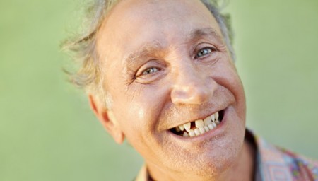 Kỹ thuật trồng răng Implant là gì 