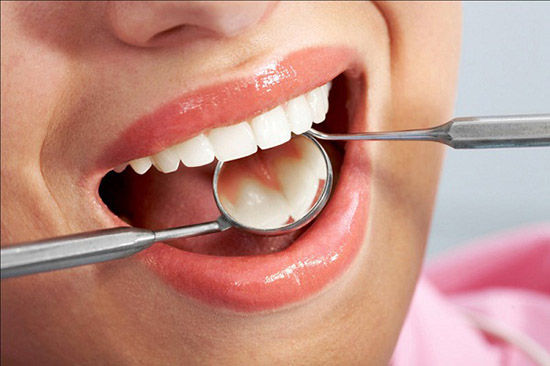 độ bền của răng sứ thẩm mỹ